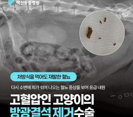 처방식을 먹어도 재발한 혈뇨, 고…